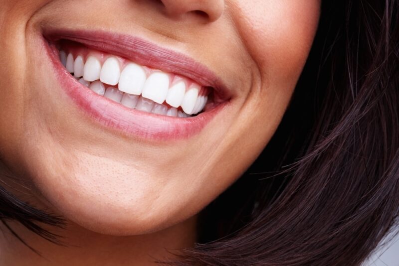 Cosmetic Dentist Hattiesburg
